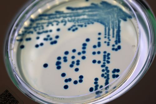 When Resistance and Virulence go hand in hand